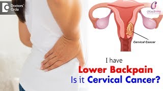 Warning Signs of Cervical Cancer  Is lower backpain a sign of Cervical CancerDr Sapna Lulla of C9 [upl. by Wellesley]