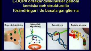 Angela Cenci Nilsson  Ldopabehandling vid Parkinson [upl. by Georgiana]