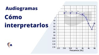 AUDIOGRAMA  Entiende el resultado de una audiometría tonal [upl. by Ynetruoc]