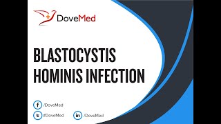 Blastocystis Hominis Infection Blastocystosis Symptoms and Causes  Diagnosis  Treatment [upl. by Gnim]