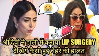 Watch How Sridevi Looked After her Recent Lip Surgery  Lip Surgery Gone Horribly Wrong [upl. by Gaivn]