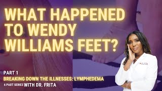 What Happened To Wendy Williams Feet Breaking Down Lymphedema Part 1 [upl. by Lorelie]