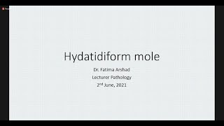 Hydatidiform Mole  Tutorial  Pathology [upl. by Anayrb361]