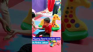 Flapping Hands in Autistic child [upl. by Ellynn]