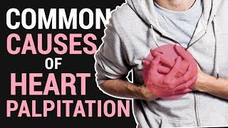 Common Causes of Heart Palpitation  by Dr Willie Ong 53b [upl. by Jobyna]