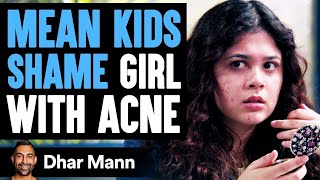 MEAN KIDS Shame Girl With ACNE What Happens Next Is Shocking  Dhar Mann [upl. by Katine]