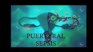 Puerperal SepsisMidwifery and Obstetrical NursingBsc Nursing [upl. by Rinna]