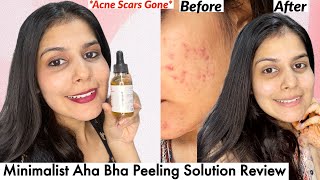 Minimalist 25 AHA 5 PHA 2 BHA Peeling Solution Review  Aha Bha Serum For Beginners [upl. by Fleta]