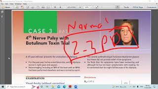 lecture three 4 th nerve Palsy with Botulinum toxin trial [upl. by Epifano]