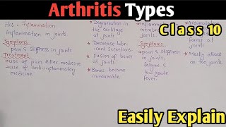 Arthritis  Osteoarthritis  Rheumatoid  Gout  Class 10 Biology UrduHindi [upl. by Hasheem12]