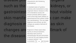 Systemic Sclerosis sine Scleroderma rheumatology scleroderma sclerosis [upl. by Enoj]