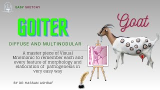 Goiter Pathology Diffuse and Multinodular  Visual Mnemonic  Endocrinology  Crack NEET PG USMLE [upl. by Singhal763]