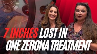 Zerona Fat Loss Laser by Erchonia  Patient Testimonial [upl. by Kinnie]