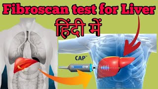 What is Fibroscan Test for Liver Explained in Hindi  Use Price and Normal Range [upl. by Burk]