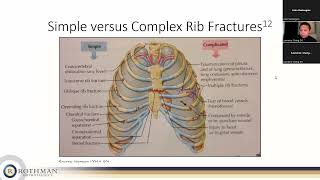 Management of Traumatic Rib Fractures [upl. by Ecerahc325]