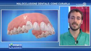 Il Mio Medico  Malocclusione dentale come curarla [upl. by Lavena]