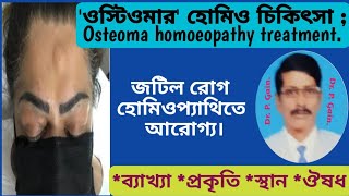 736 ওস্টিওমার হোমিওপ্যাথি চিকিৎসা  Osteoma homoeopathy treatment [upl. by Arbmahs]