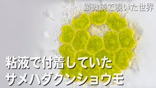 ちいさい石に付着していたサメハダクンショウモ Pediastrum boryanum [upl. by Eillit]