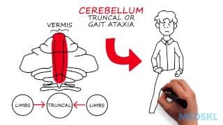 Neurology – Ataxia Gait – By Wendy Stewart MD [upl. by Estis]