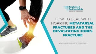 How to Deal with Horrific Metatarsal Fractures and the Devastating Jones Fracture [upl. by Janenna]