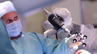 Knee replacement using the Stryker Mako Robot [upl. by Trici]