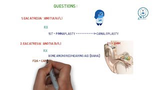 Diseases of external ear Congenital disorder  1 [upl. by Brigida]