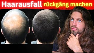 Haarverlust Effektiv Reduzieren amp Rückgängig machen kein Wunder aber real [upl. by Arutnev489]