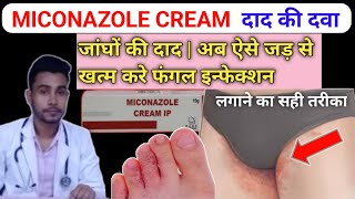 miconazole nitrate cream ip micogel best antifungal cream nafeeshealthcare [upl. by Ogires]