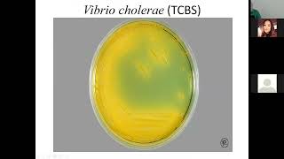 Microbiology  Lecture 8  Vibrio  Aeromonas  Campylobacter [upl. by Teriann]