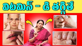 Vitamin D Deficiency  Vitamin D Deficiency Symptoms  Dr Aruna Devi  iDream Health Talks [upl. by Simara]