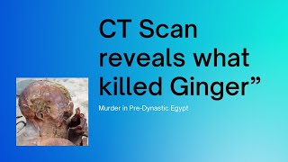 CT Scan Reveals What Killed Gebelein Man quotGingerquot the worlds oldest tattooed man amp his companion [upl. by Yrrap]