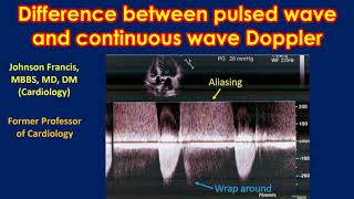 Difference between pulsed wave and continuous wave Doppler [upl. by Aicnelev10]