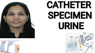 Catheter specimen urine NMC OSCECatheter specimen collection [upl. by Neerol837]