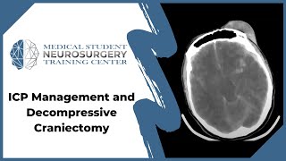 ICP Management and Decompressive Craniectomy [upl. by Anauqahs904]