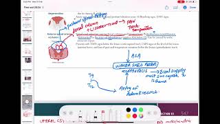 Anterior spinal artery occulusion neurology 146  First Aid USMLE Step 1 in UrduHindi [upl. by Cannell]