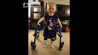 Arthrogryposis Diagnosis and Treatment  Patient Testimonial Ana [upl. by Inttirb66]