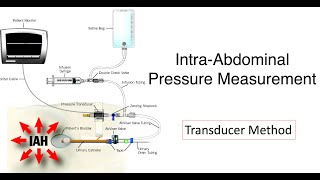 Intraabdominal Pressure Measurement II Cough Test for IAP II ICU Bedside Procedure [upl. by Nathalia204]