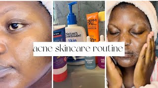 Affordable Skincare Routine For Acne and Dark marks [upl. by Euginomod]