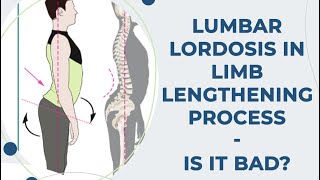 Lumbar Lordosis in Limb Lengthening Process I Wanna Be Taller [upl. by Nymsaj]