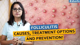 Folliculitis Causes Treatment Options and Prevention  shorts [upl. by Chenay303]