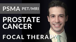 PSMA PETMRI Prostate Cancer Patients and Focal Therapy [upl. by Johansen]