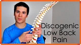 Diagnosis and Treatment of Discogenic Low Back Pain [upl. by Retha939]