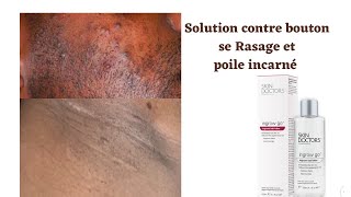 SOS POILS INCARNÉS ET BOUTONS DE RASAGE🥺maillot barbe aisselles visage  INGROWN HAIRS solution😍 [upl. by Middendorf634]