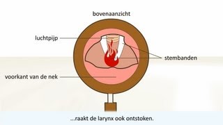 Keelontsteking  de oorzaak en behandeling [upl. by Eissac]