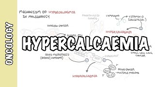 Hypercalcemia in malignancy  causes pathophysiology symptoms treatment [upl. by Simmonds]