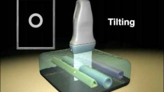 Ultrasound Transducer Manipulation [upl. by Hecklau]