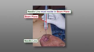 Fine Needle Aspiration Biopsy FNA Techniques  Ultrasound Guided FNA The Parallel Approach [upl. by Barbaraanne]