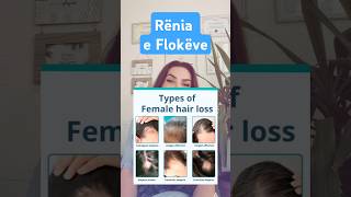 Renja e flokeve floket hairloss alopecia lekura hairlosstreatment floku imunitet vitamina [upl. by Holmann]