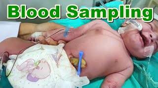 Blood Sampling in Newborn  Neonate Using Butterfly Line  Arterial Blood Sample  Baby  Paediatric [upl. by Atalanta736]