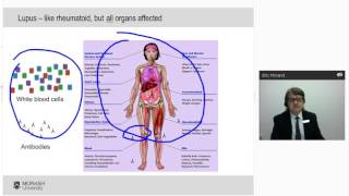 The Diagnosis and Management of Lupus [upl. by Gibe]